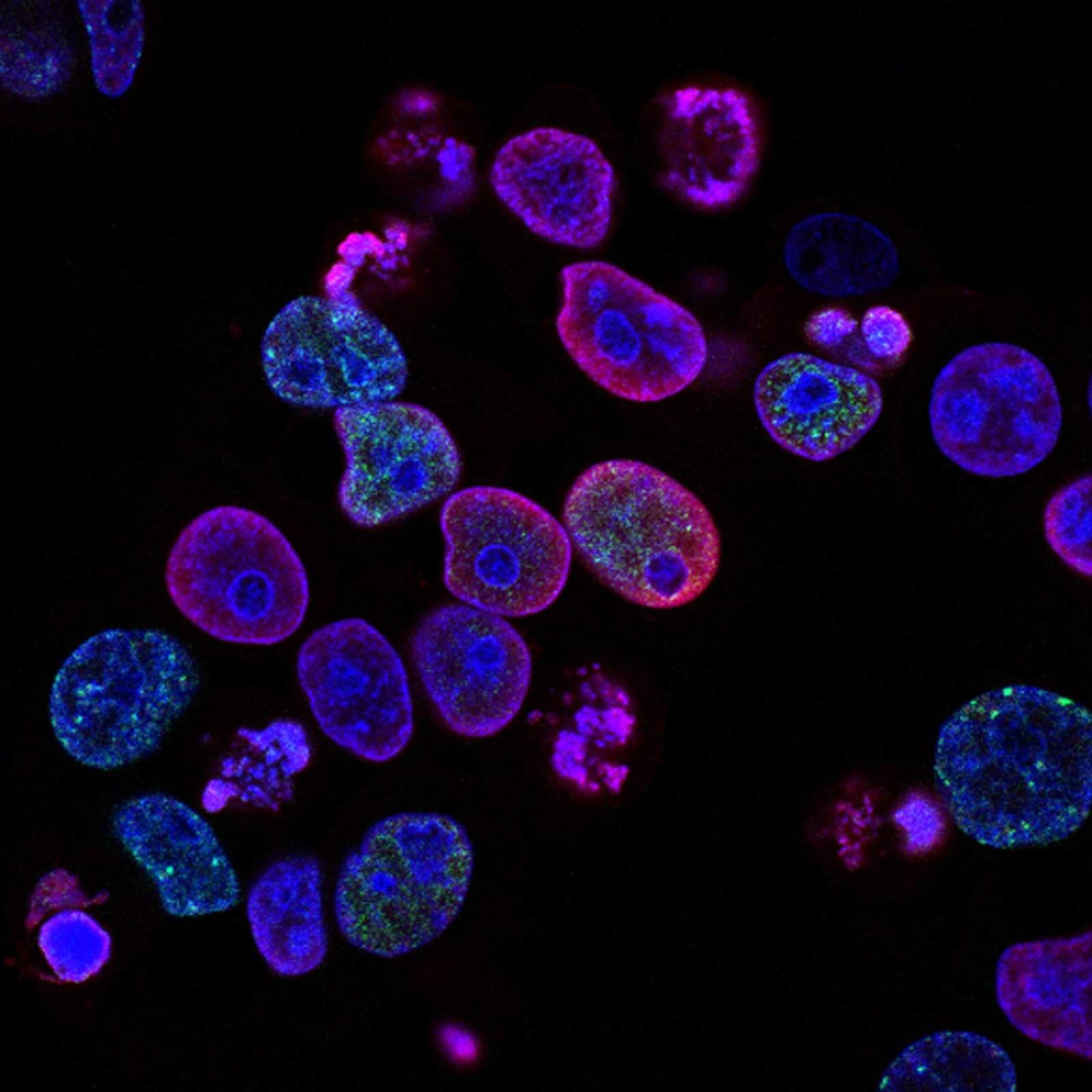 Cancer Research, News